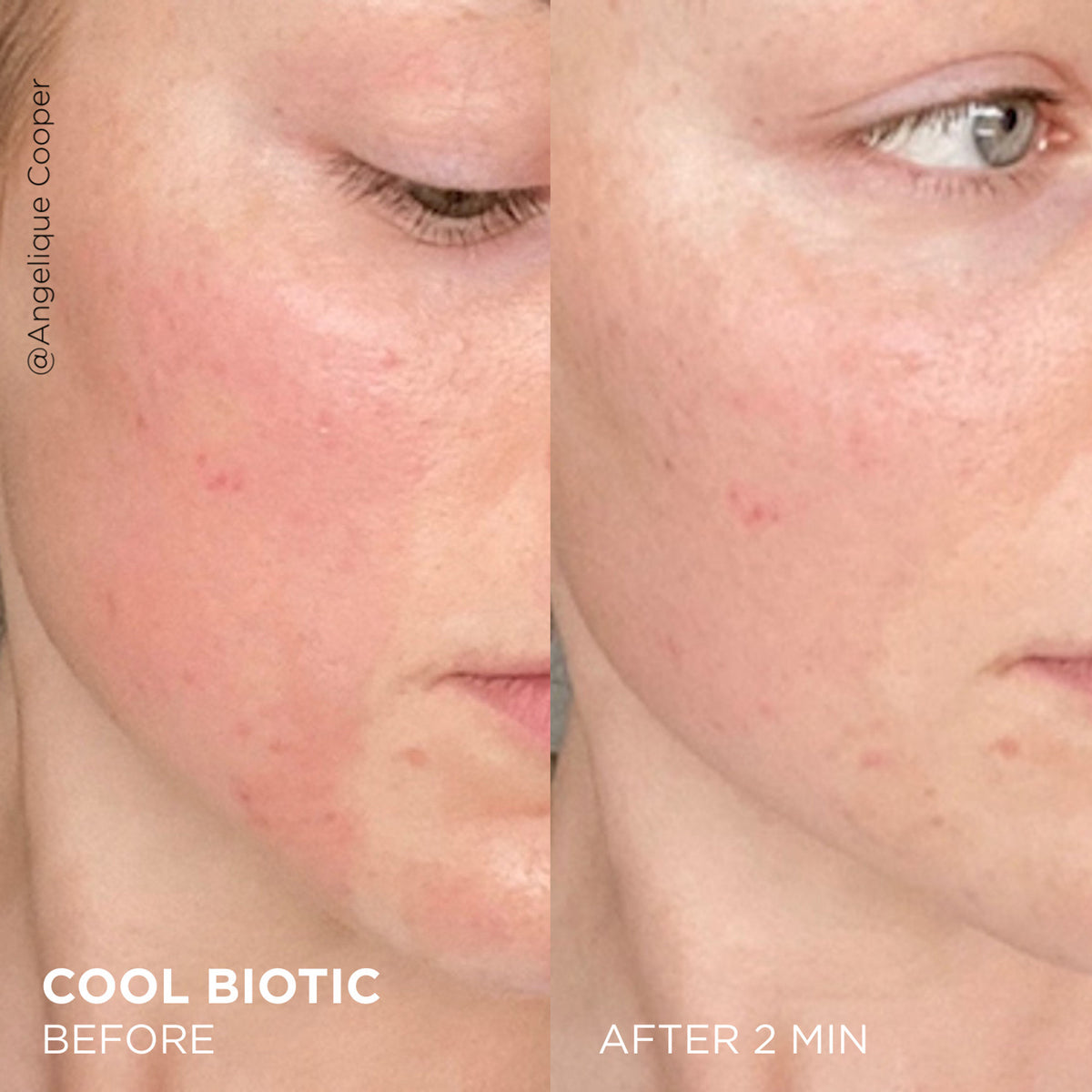 Dr. Brandt Cool Biotic Prebiotic Redness Relief Cream face moisturizers